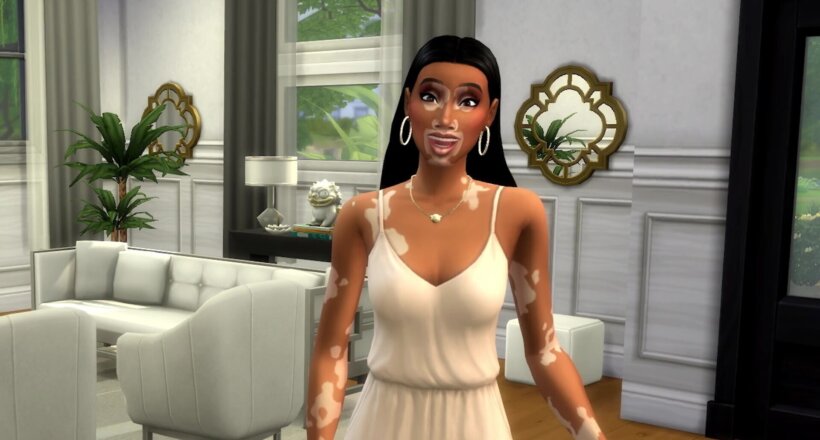 Die Sims 4 Vitiligo Haut Feature